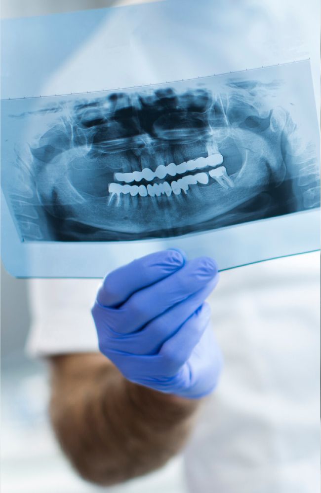 Un dentista osserva una radiografia panoramica